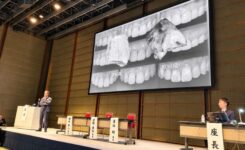 インプラント学会での講演