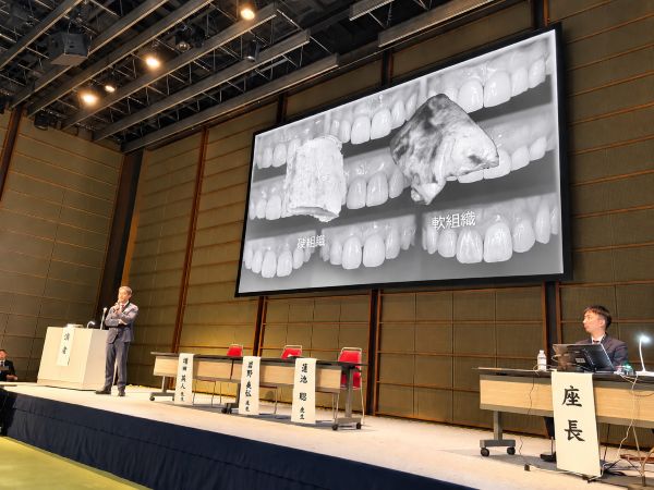 インプラント学会での講演